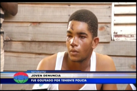 Joven Denuncia Golpiza Recibida Por Teniente De La Policía En La Comunidad De Yaguate