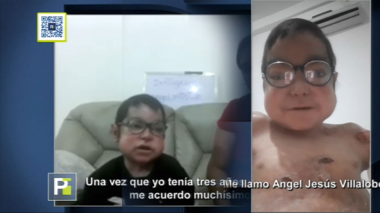 Conoce La Historia De Este Pequeño Guerrero Que Cautivara El Corazón De Muchos 