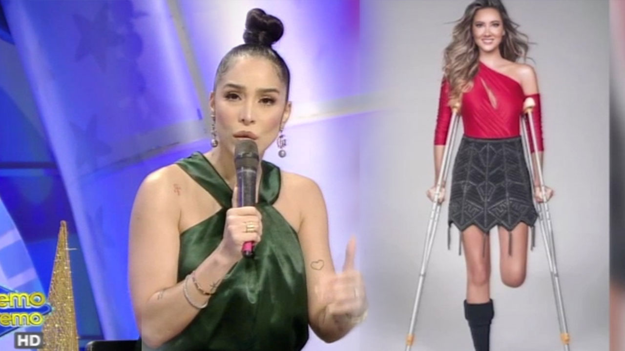 Modelo Que Perdió Su Pie Izquierdo Por Rara Enfermedad También Tiene Afectado El Pie Derecho