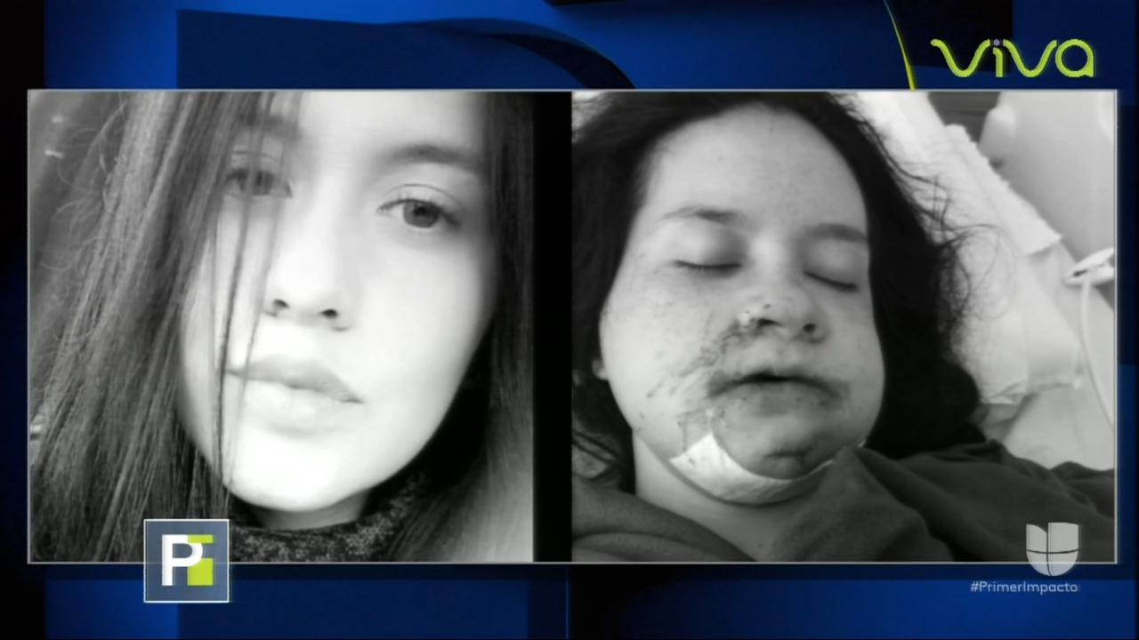 Esta Joven Sobrevive Al Caer De Una Cuarto Piso Luego De Una Golpiza