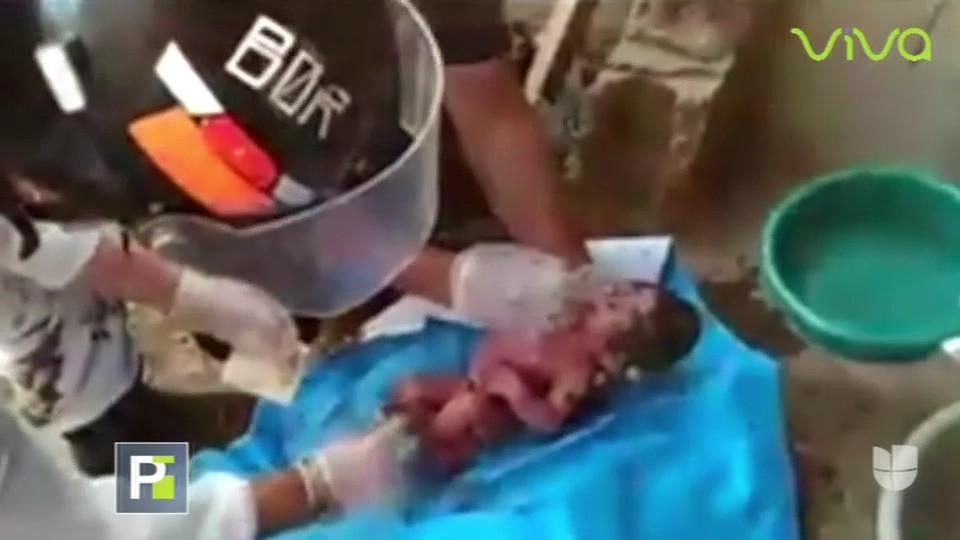 Recién Nacido Es Lanzado A Una Letrina  Y De Esta Forma Lo Rescatan