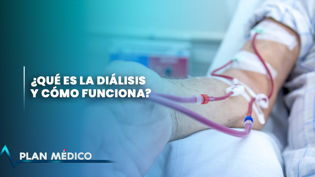 ¿Qué Es La Diálisis Y Como Funciona? | Plan Médico