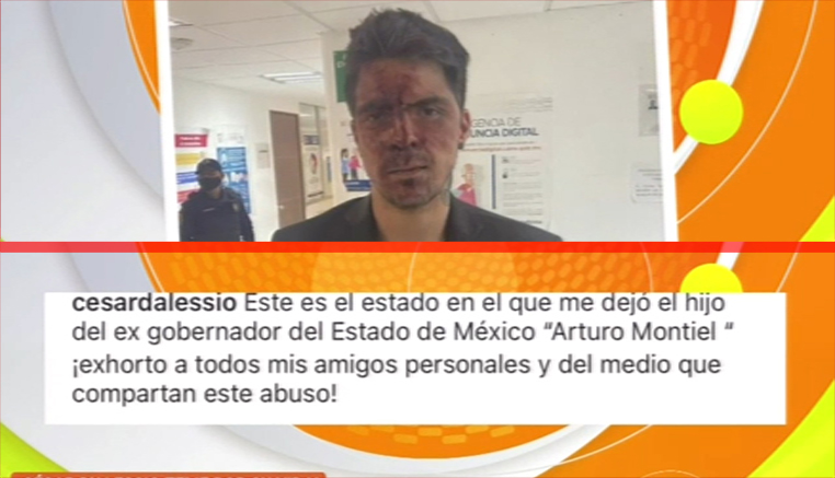Hijo De Lupita D’Alesssio Acusa A Hijo De Exgobernador De México De Haberlo Golpeado Fuertemente