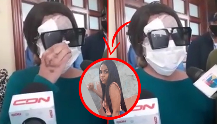 Yocairy Amarante Quien Fue Rociada Con ácido Del Diablo Habla A Las Cámaras Y Pide Que Se Haga Justicia
