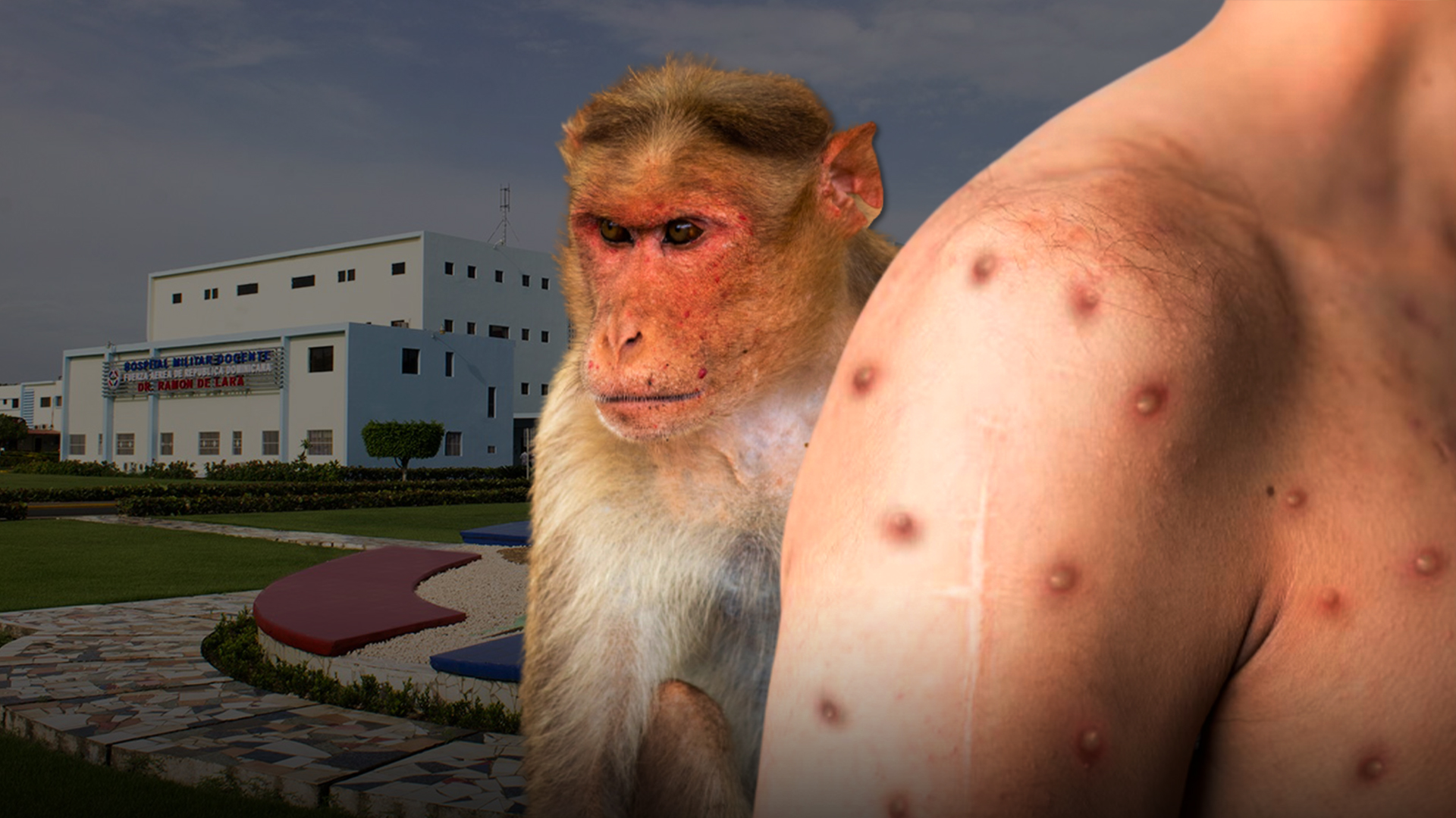 Hombre Mata A Su Mujer Y Luego La Entierra En Su Casa En Florida