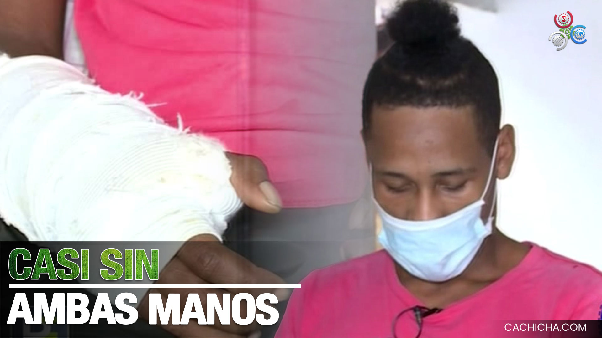 Lo Confunden Con Un Ladrón Y Casi Le Amputan Ambas Manos