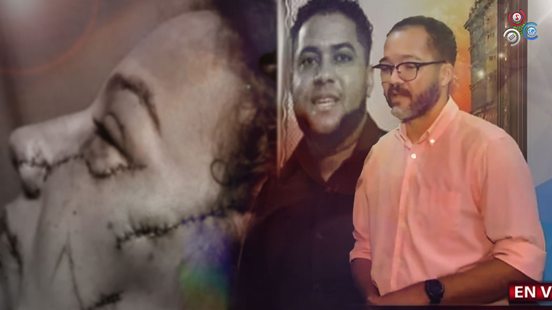 Abogado De La Mujer Que Fue Agredida De 12 Estocadas Por Su Pareja Cuenta Cómo Sucedió Todo | La Invitó A Un Lugar