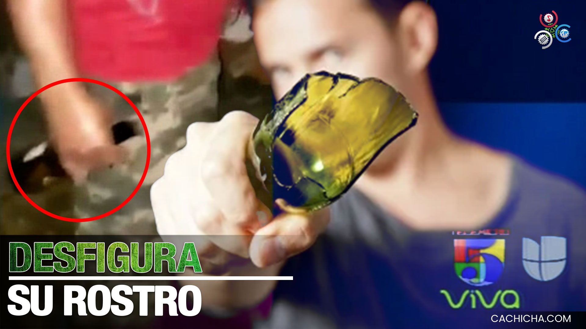 Hombre Le Corta El Rostro Con Una Botella A Su Esposa En Frente De Sus Hijos