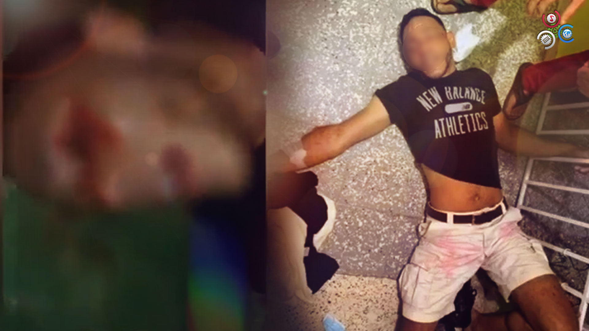 Policia Le Explota El Ojo De Un Disparo A Un Hombre Que Defendía A Un Menor De Edad De Sus Agresiones