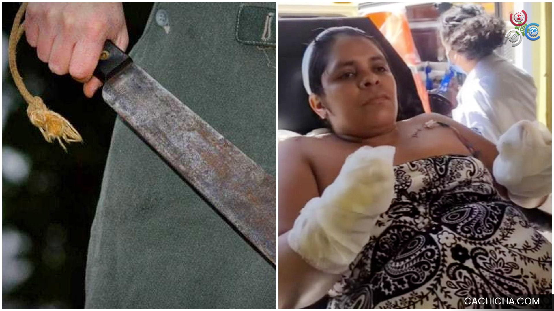 Hombre Le Entra A Machetazos A Mujer Por Negarse A Tener Un Romance | Primer Impacto