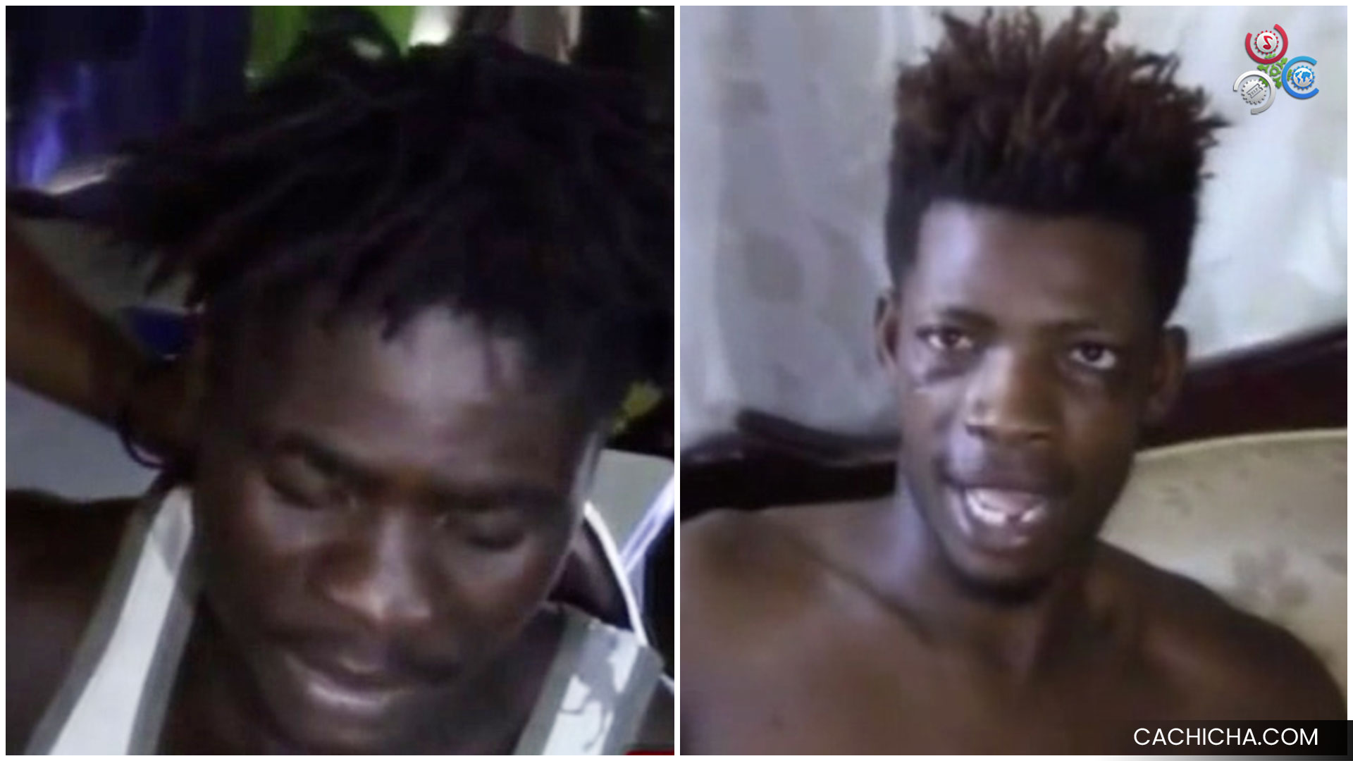 Haitiano Denuncia Patrulla Del Ejército Dominicano Lo Hirieron De Bala