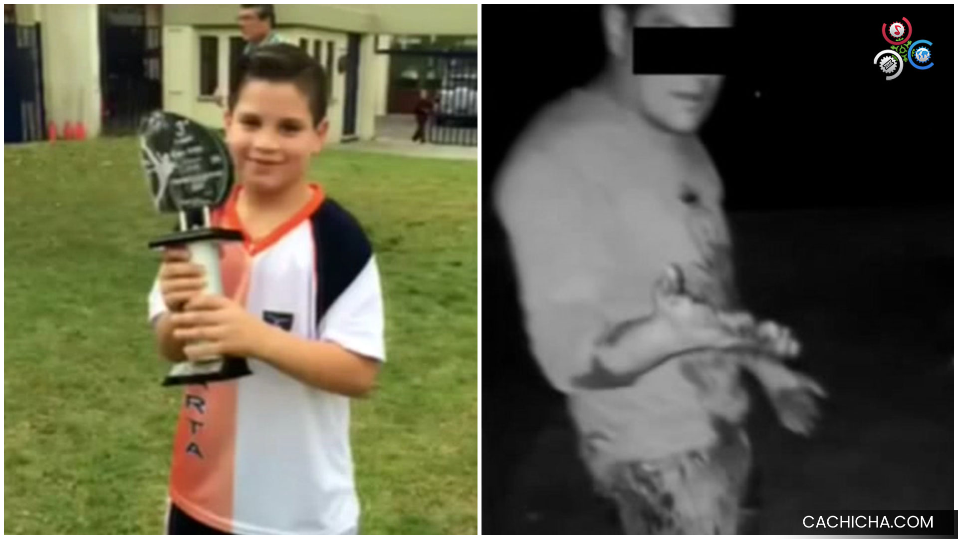 Joven De 15 Años Muere Desangrado Tras Recibir Un Botellazo En La Cabeza