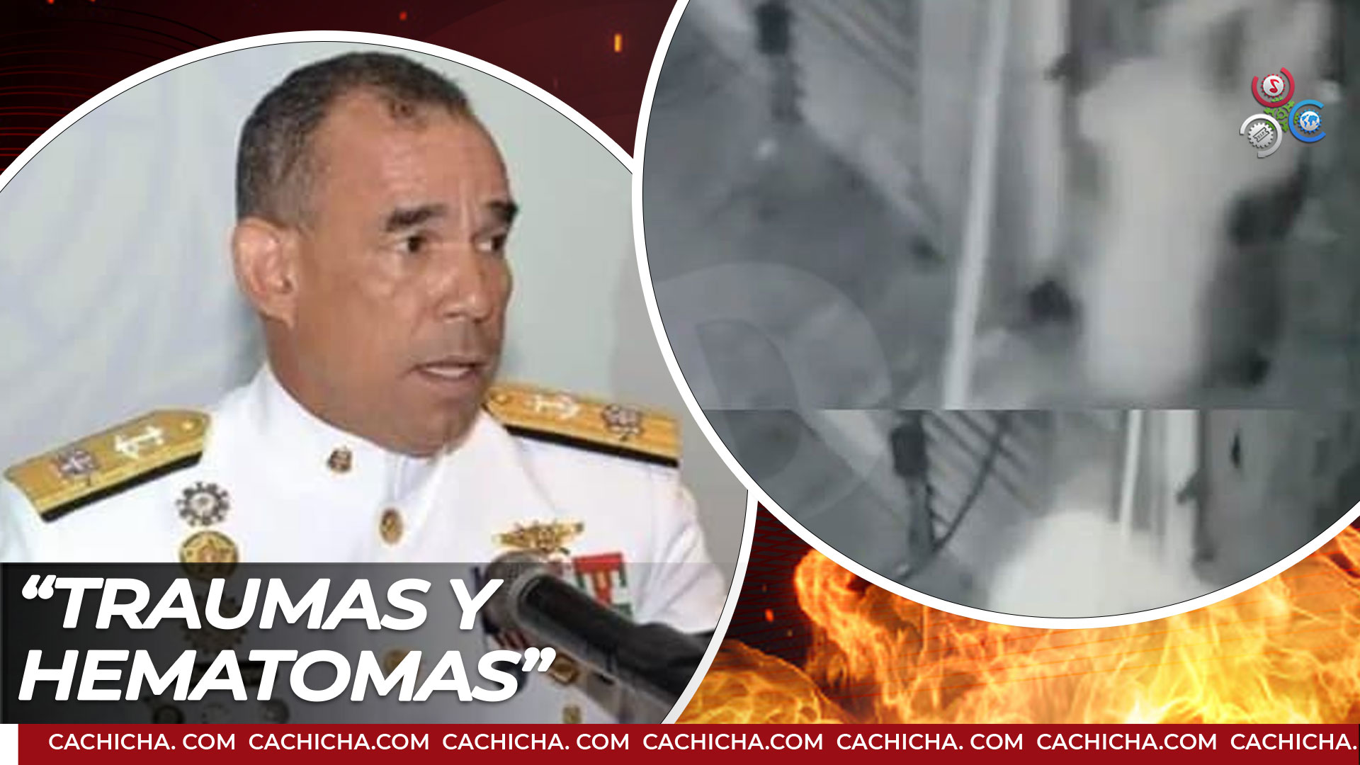 Según INACIF Comprés Presenta Traumas Y Hematomas  Más Que Noticias