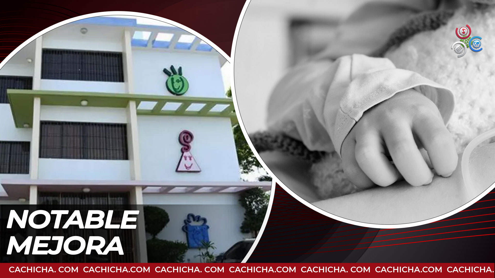 Mejora Salud Niña Que Cayó De Hogar En Conani