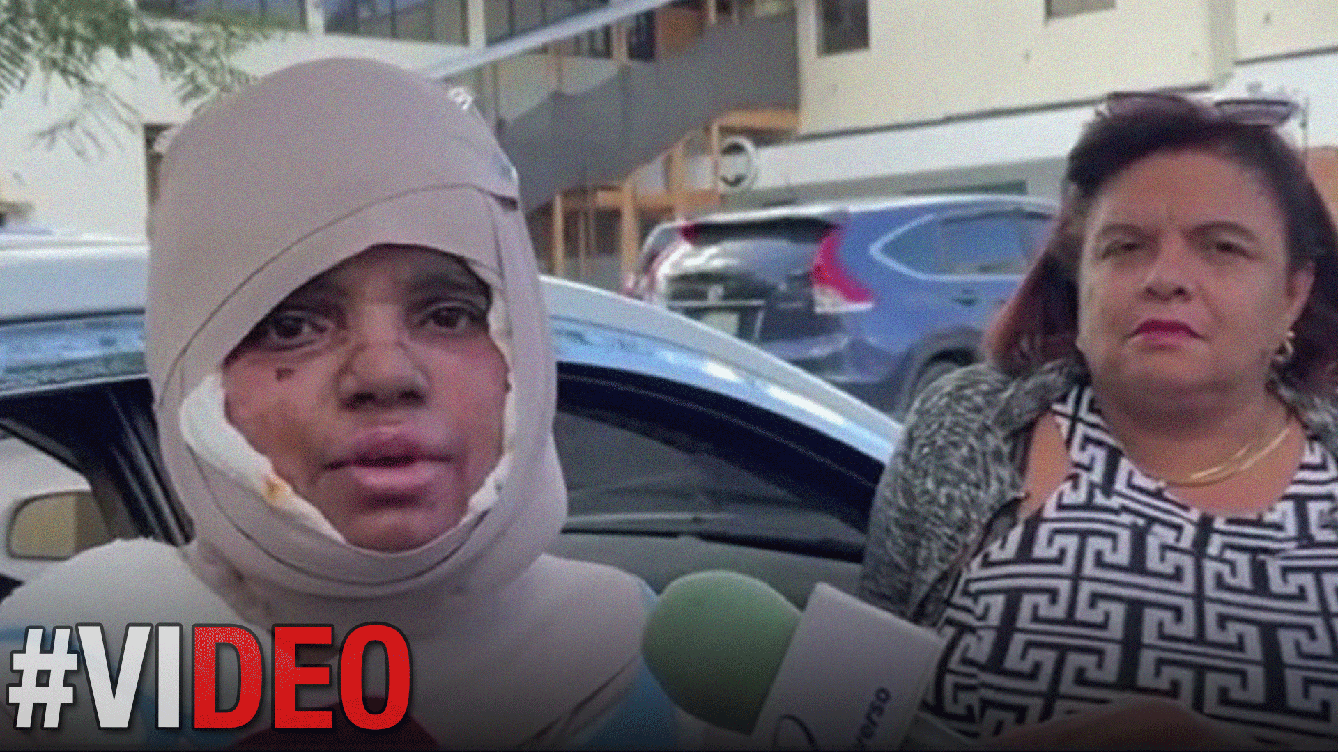 Mujer Quemada Con Aceite Caliente Por Su Expareja Teme Por Su Vida Y Exije Justicia