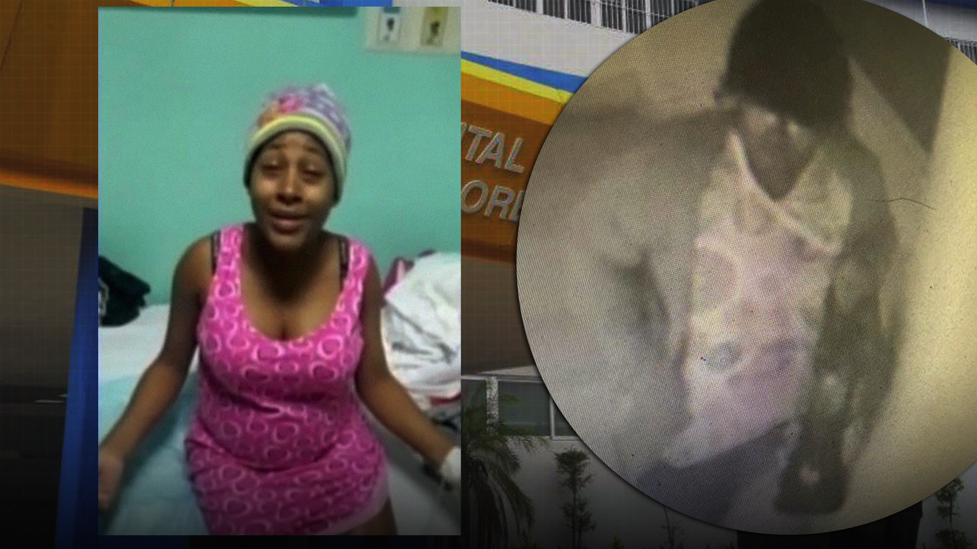 Bebé Robada De La Maternidad De Los Mina | Denuncian Falta De Interés De Las Autoridades 