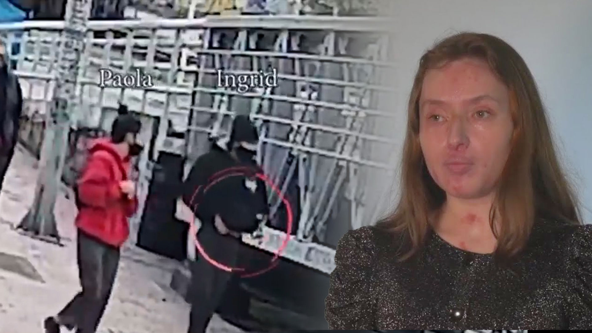 Mujer Sobrevive Ataque De Ácido De Su Ex Pareja Y Cuenta Cómo Cambió Su Vida