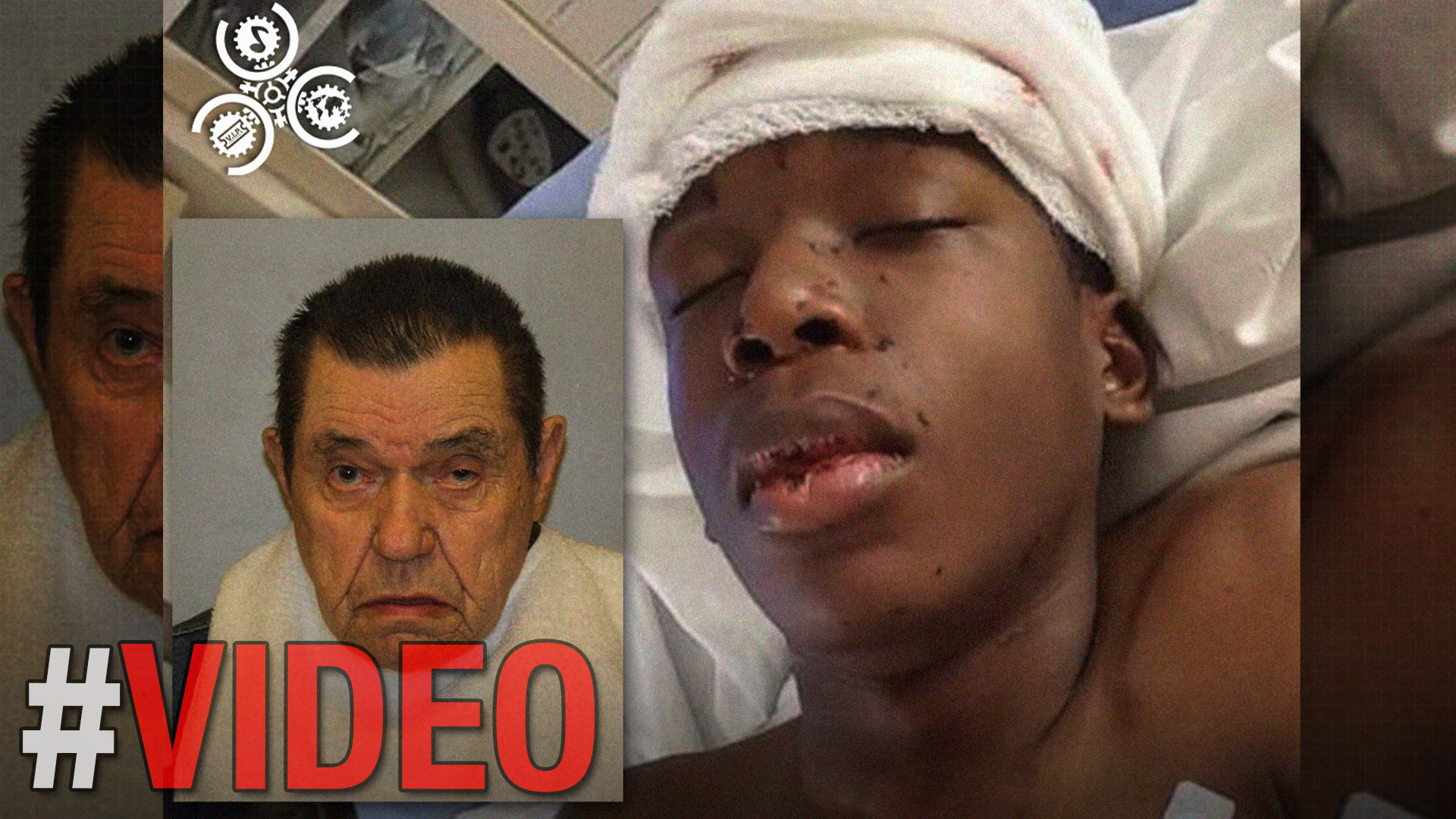 Sobrevive A La Muerte Joven De 16 Años Baleado Por Tocar Una Puerta Equivocada 