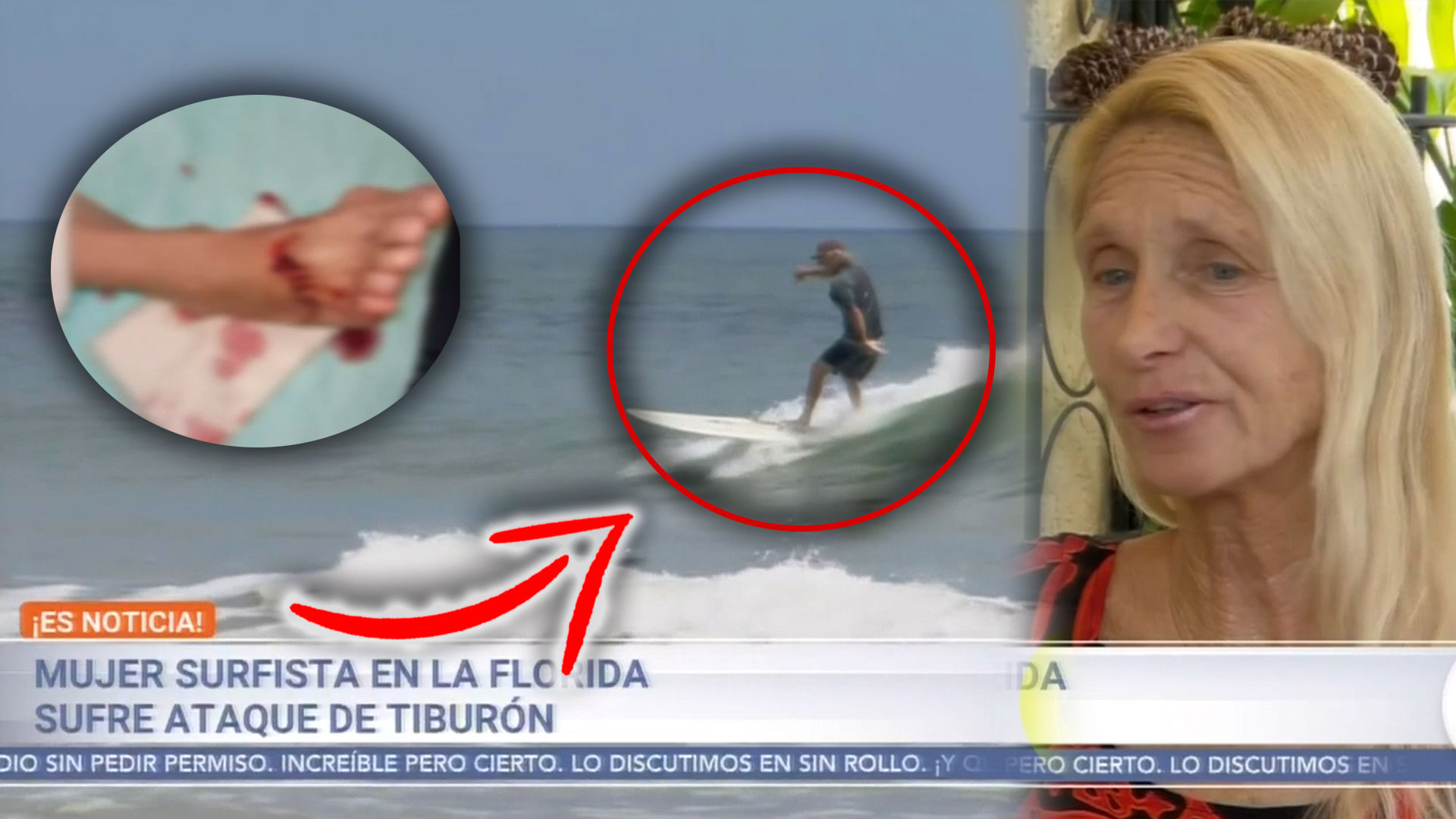 Surfista Cuenta La Historia De Cómo Fue Mordida Por Un Tiburón ¡Sorprendentes Declaraciones!