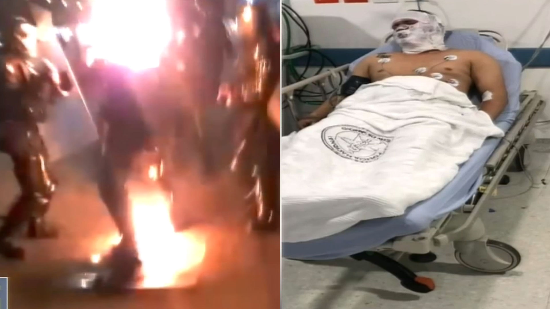 Entre La Vida Y La Muerte Un Policía Que Le Prendieron Fuego En Medio De Una Protesta 