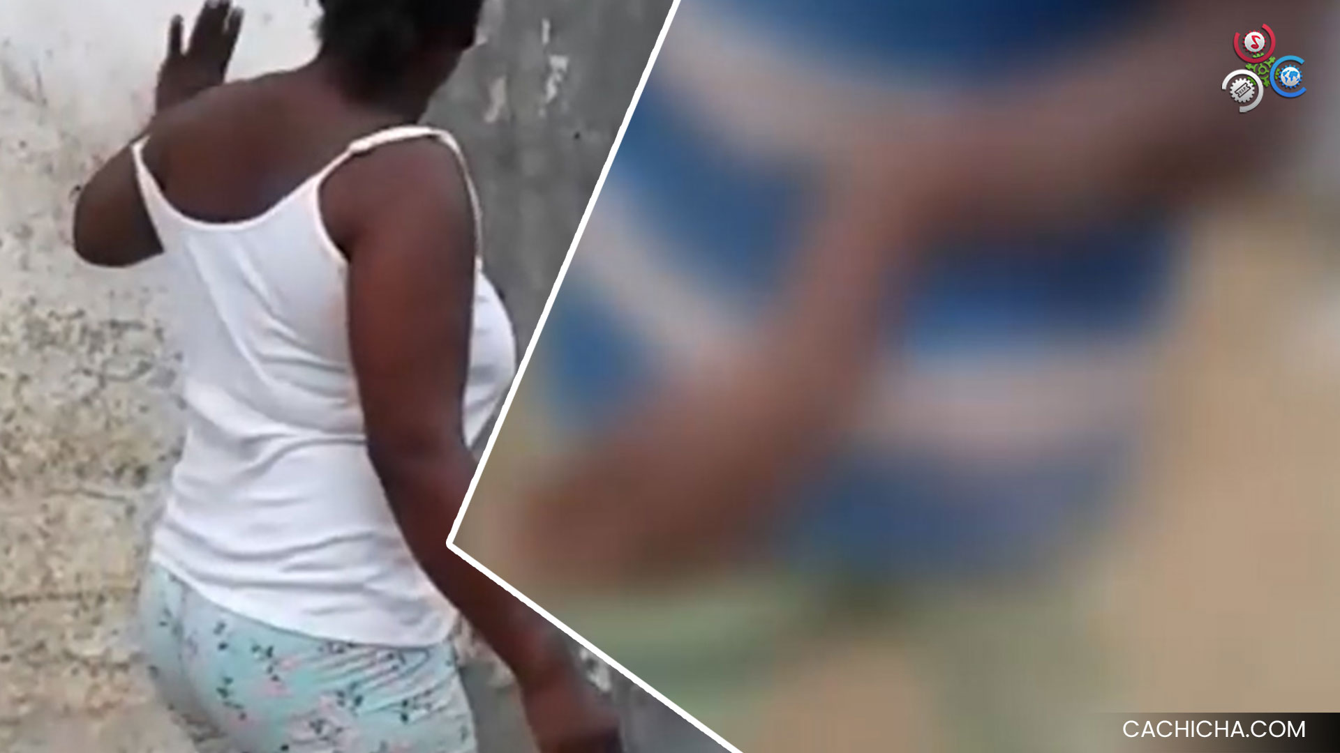 Madre De Nacionalidad Haitiana Maltrata A Su Hijo Hasta Romperle Un Brazo