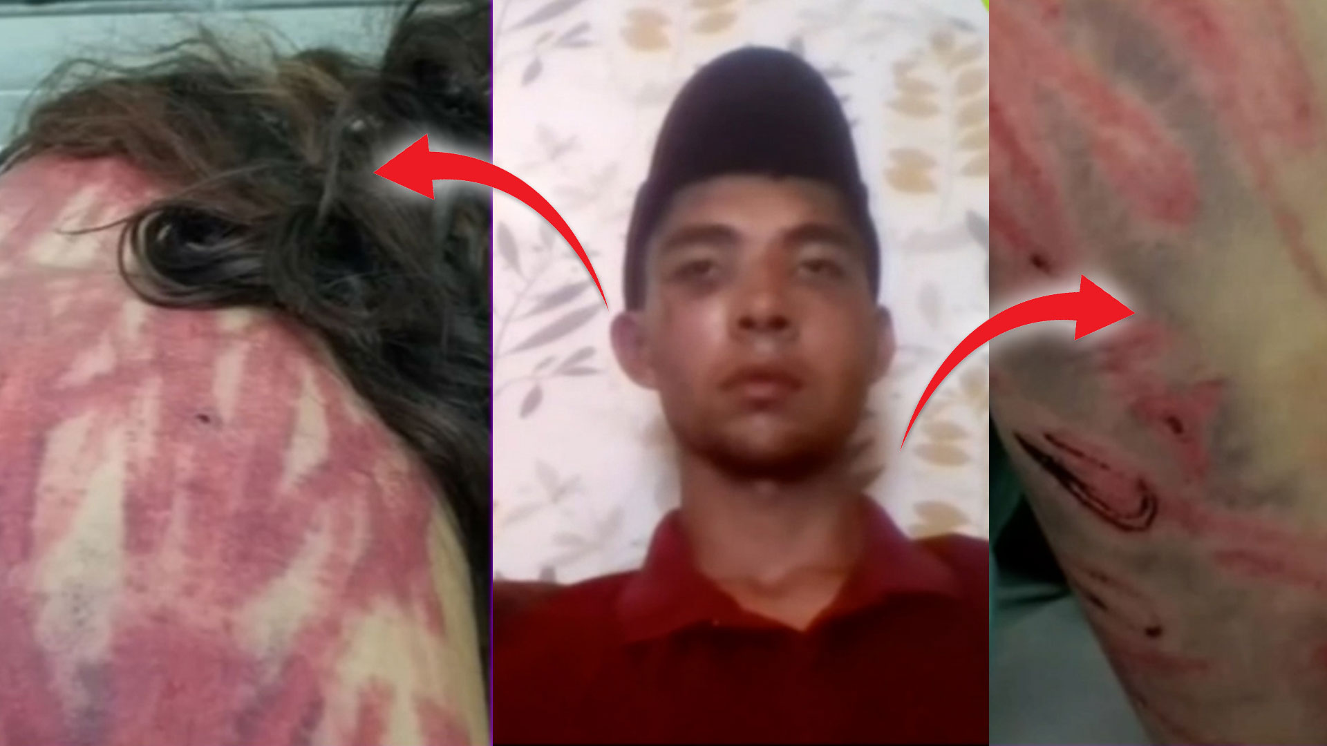 Cantante Acusado De Golpear Brutalmente A Su Primo Y La Novia