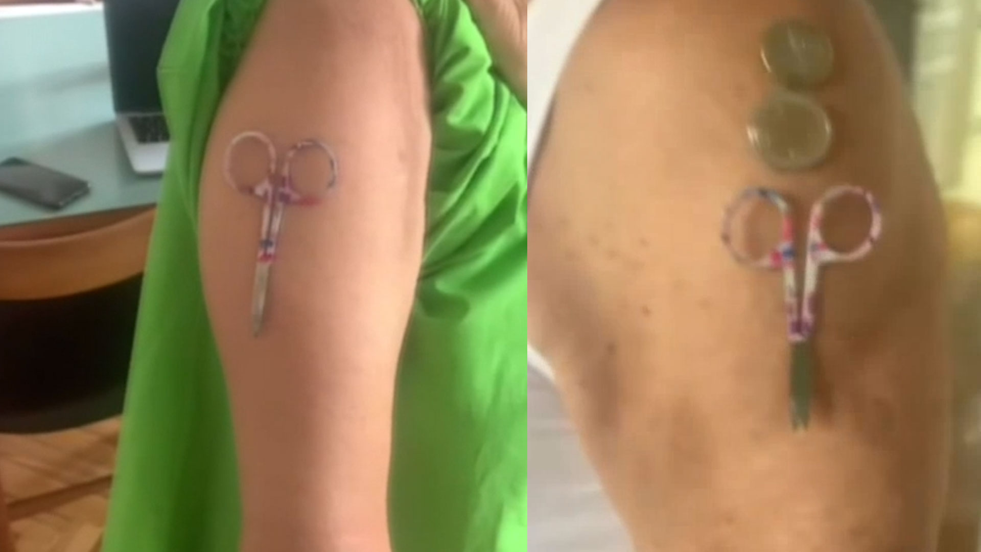 Doctores Desmienten Que Se Esté Inyectando Algún Tipo De Metal A Través De La Vacuna Del Covid 