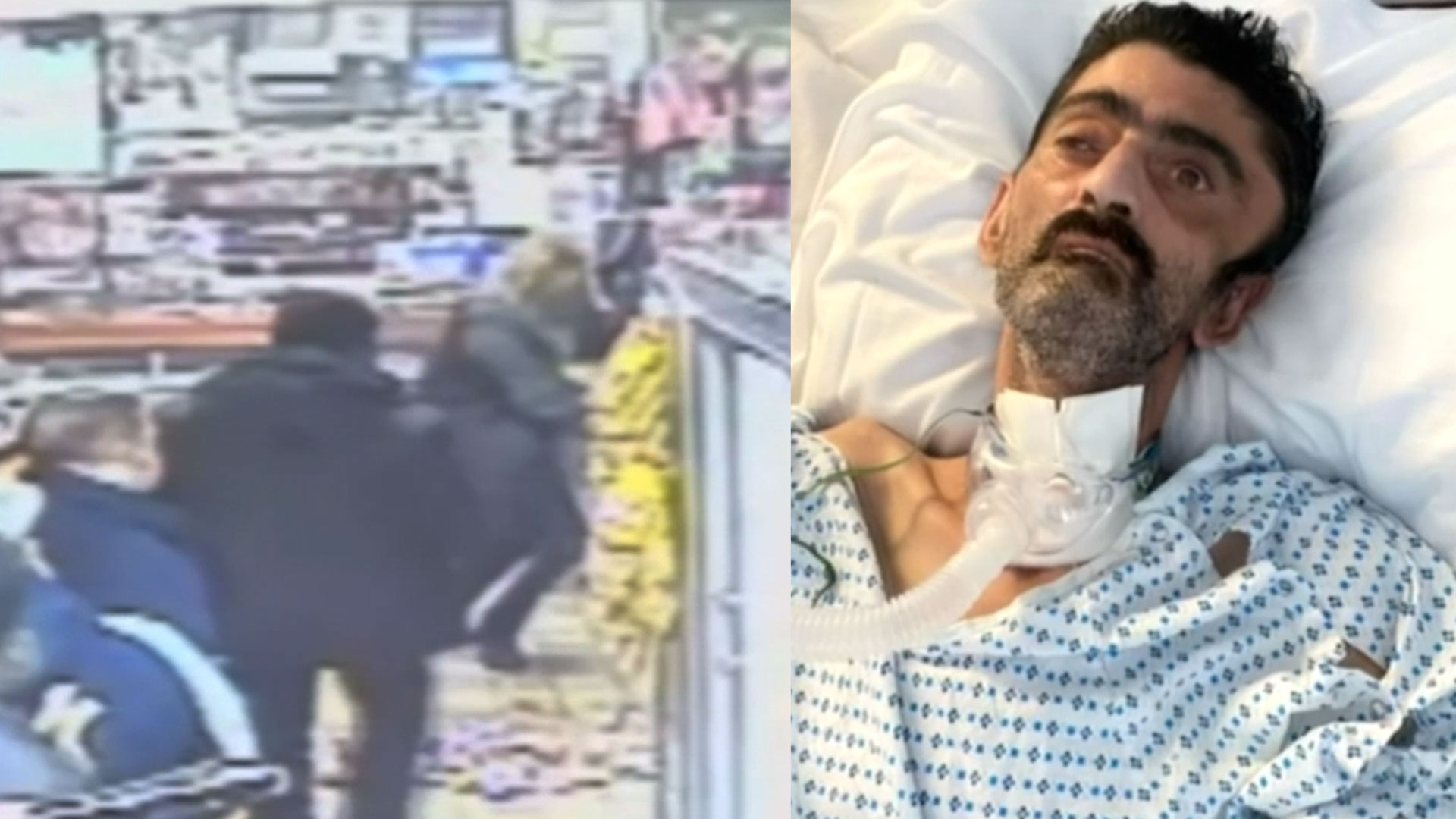 Hombre Fallece En Un Hospital Cuatro Meses De Recibir Una Paliza Tras Discutir “por Unos Dulces” 