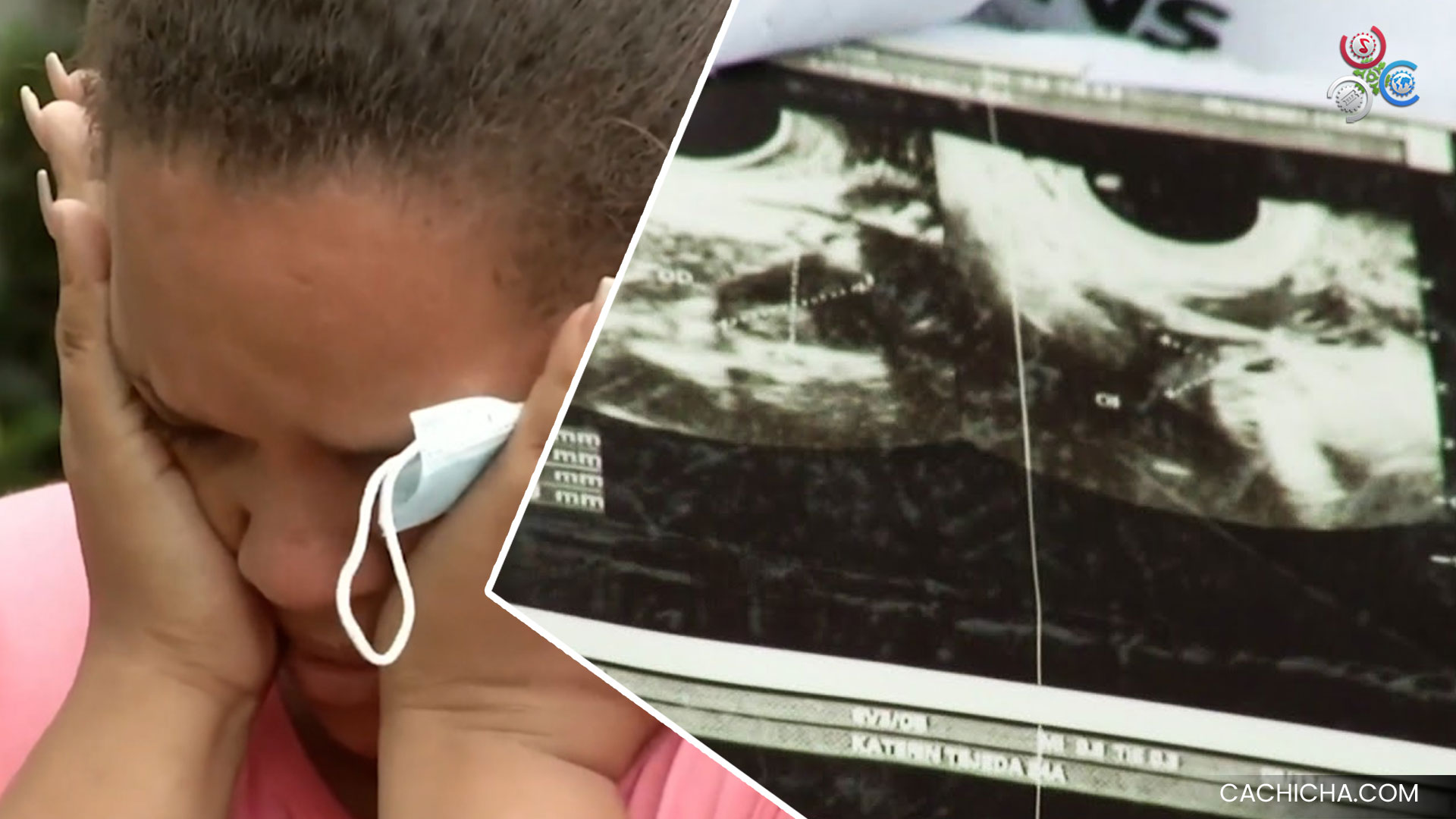 Apuñalan A Mujer Embarazada En Su Propia Casa