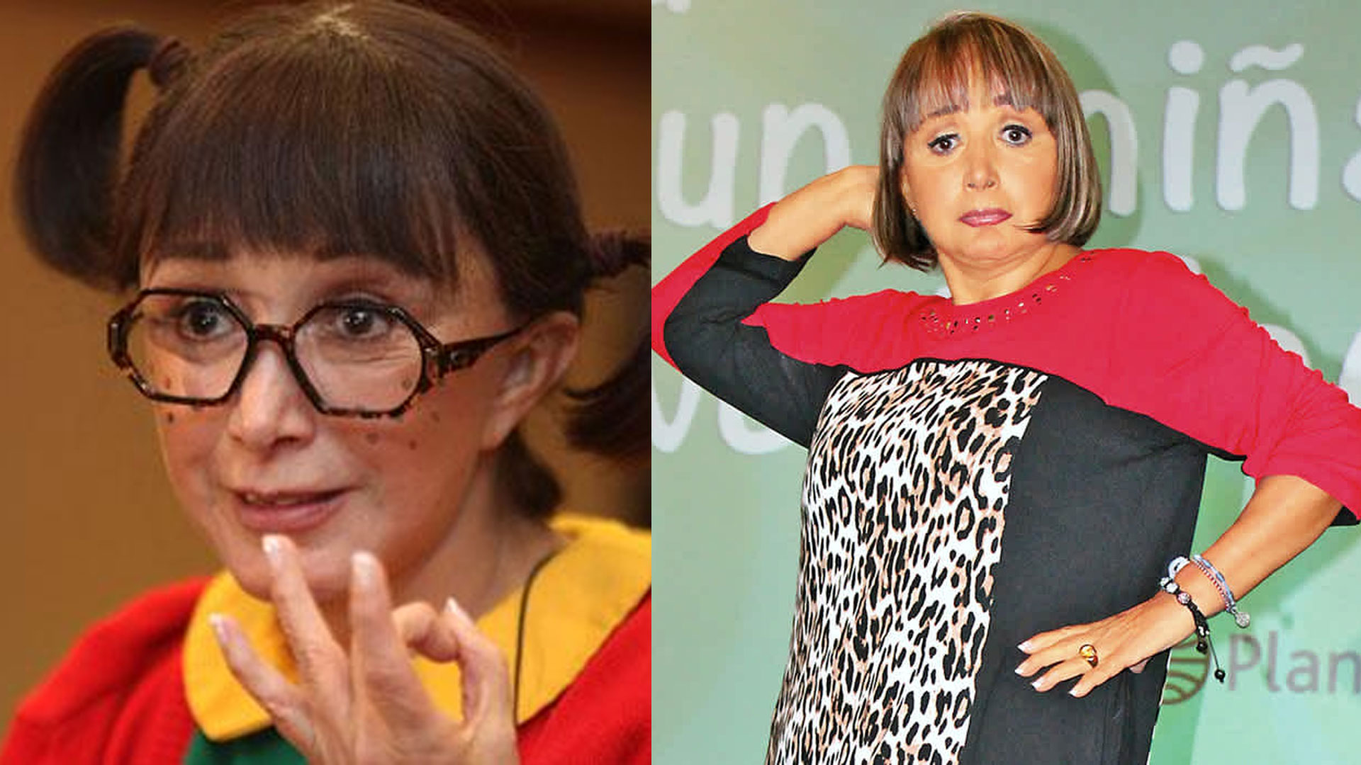 La “Chilindrina” Se Quitó 20 Años De Encima Con Ayuda Del Bisturí