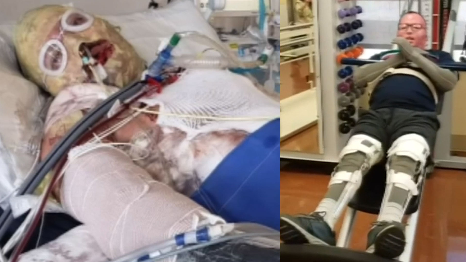 Perdonan Deuda De Dos Millones De Dólares A Un Paciente Que Recibió Tratamiento En Un Hospital 