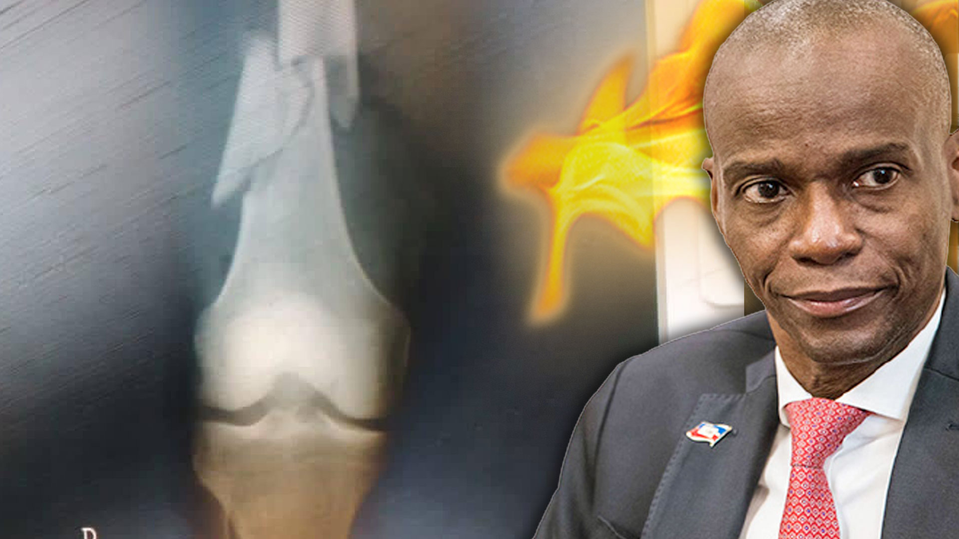 Se Filtran Fotografías Del Cuerpo Del Presidente Haitiano Que Revelan Una Fuerte Tortura 