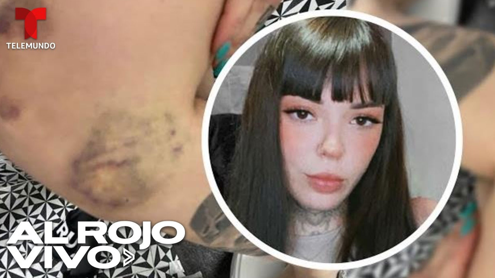 Influencer Acusa A Su Novio De Darle Una Paliza Y Publica Las Fotos En Las Redes