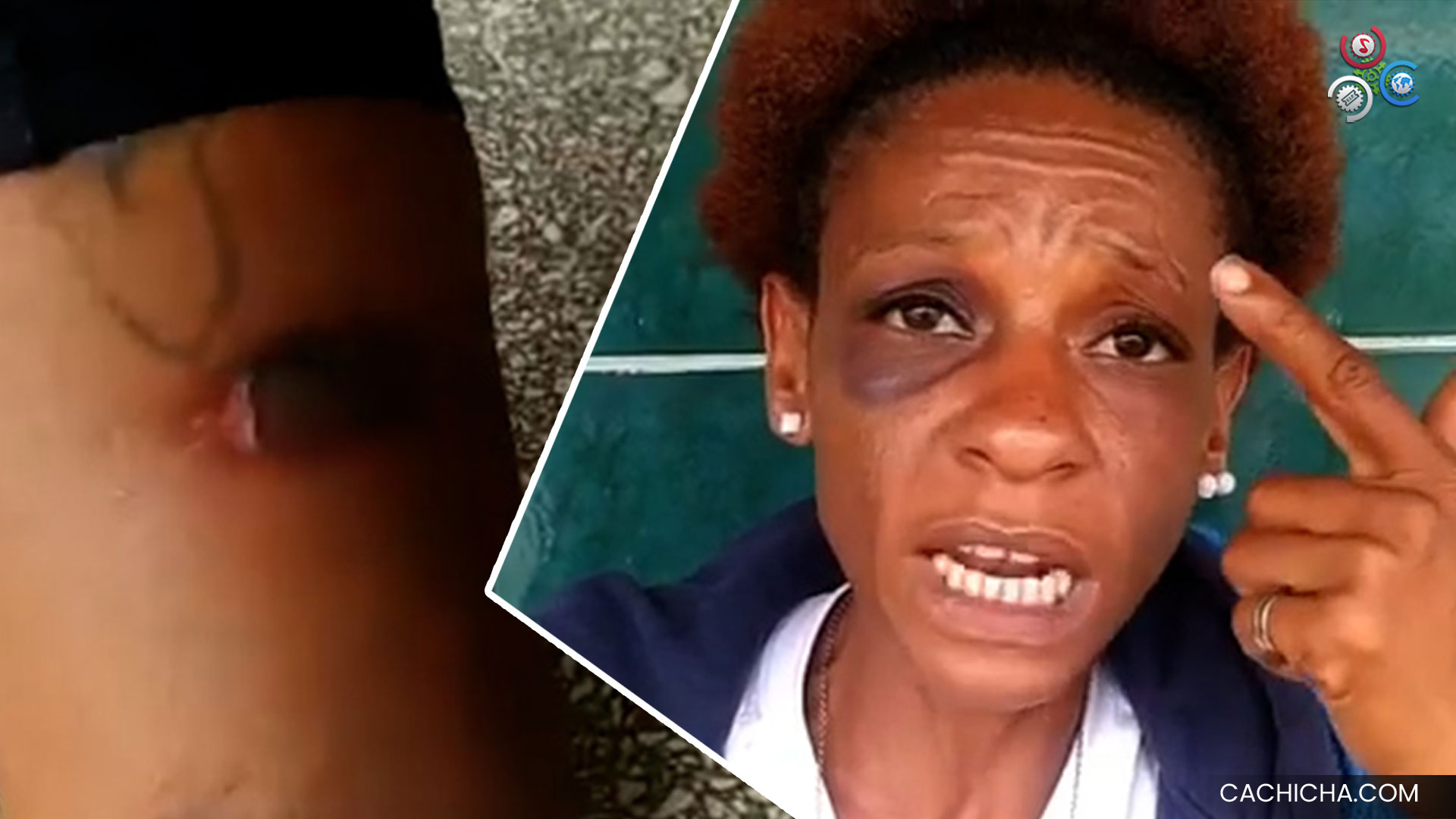 Fue A Denunciar Su Ex Pareja Por Maltrato