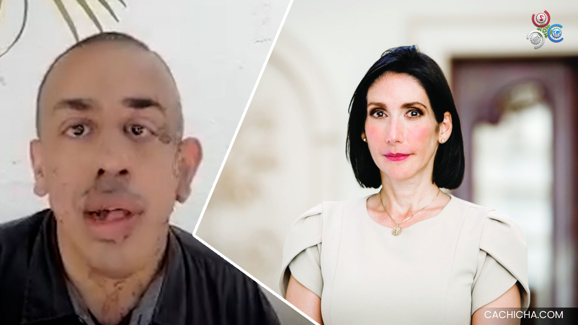 Discriminado Por Apariencia Hace Llamado Para Un Empleo