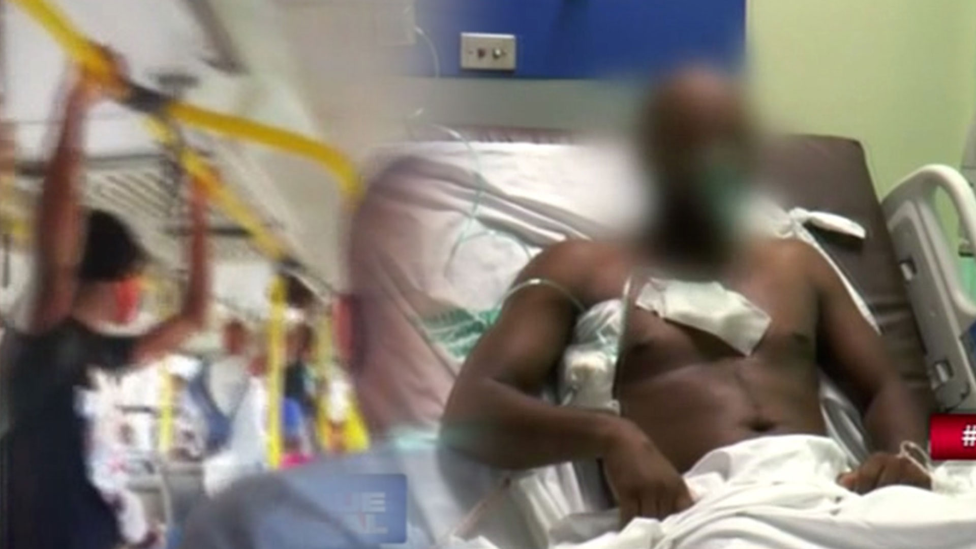 Se Encuentra Estable Chofer De La OMSA Herido Por Pasajero