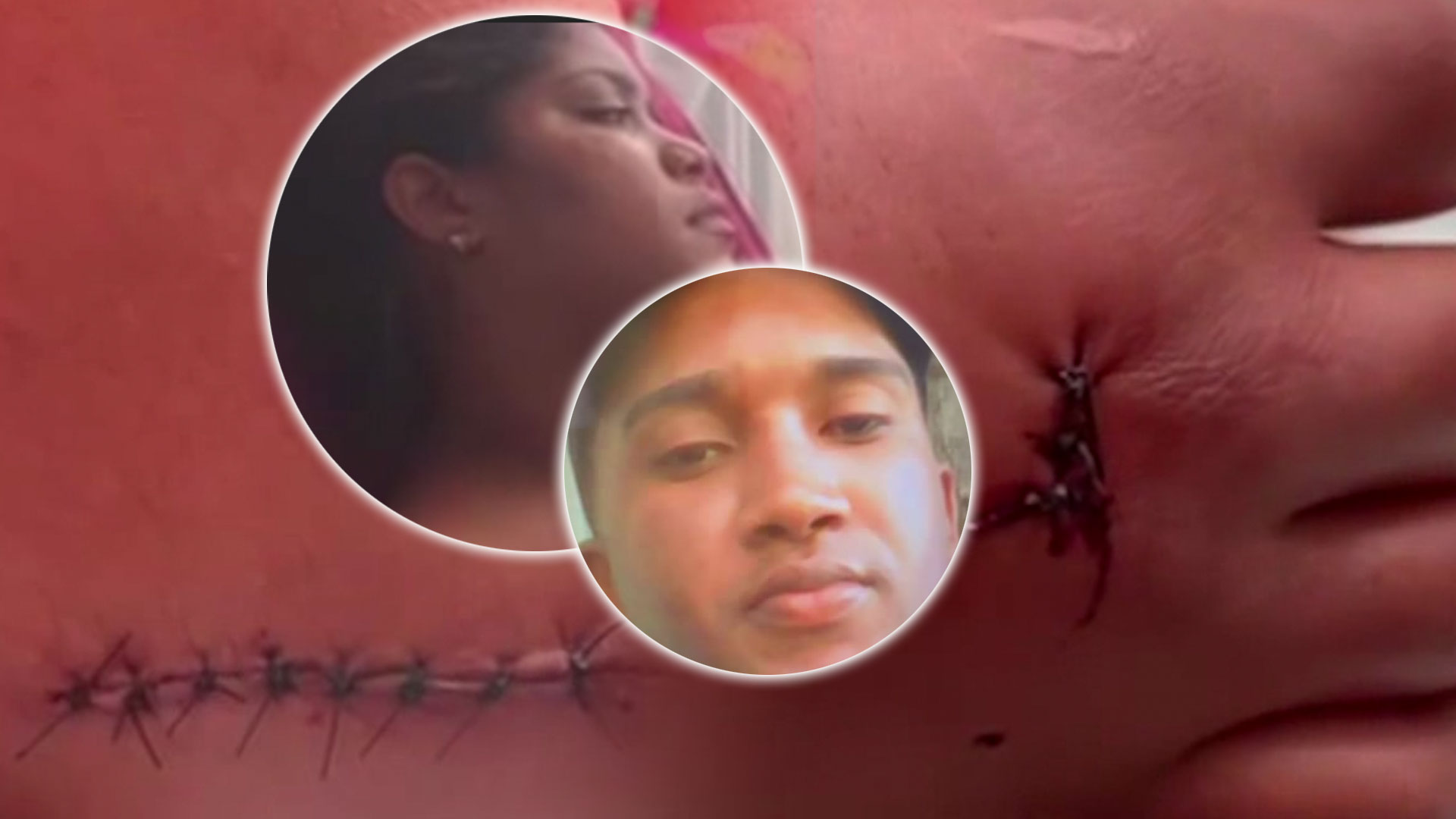 Hombre Apuñala A Su Pareja Supuestamente Por Negarse A Volver Con Él 