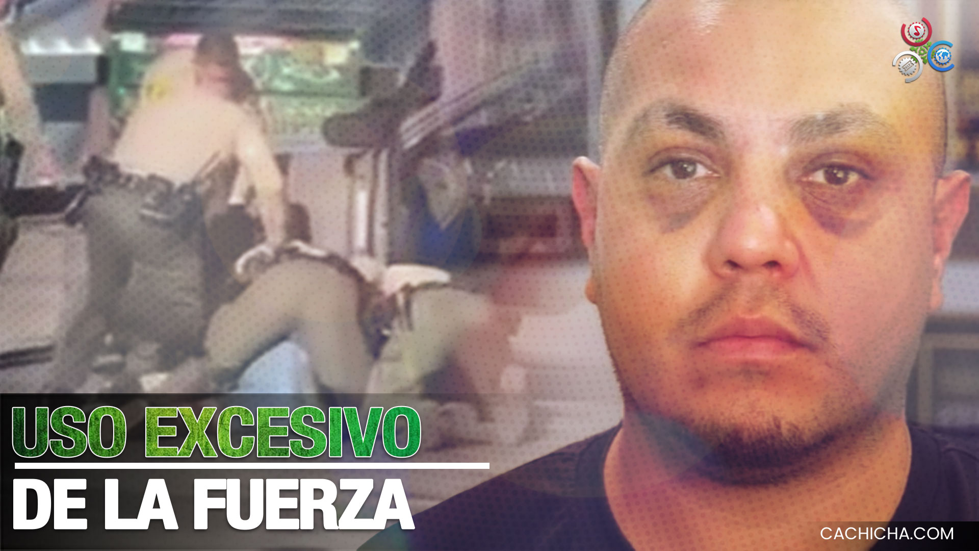 Así Quedó Un Hispano Después De Que Varios Policías Le Entraran A Golpes