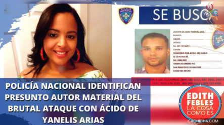 Policía Nacional Identifica Presunto Autor Material Del Brutal Ataque Con ácido De Yanelis Arias