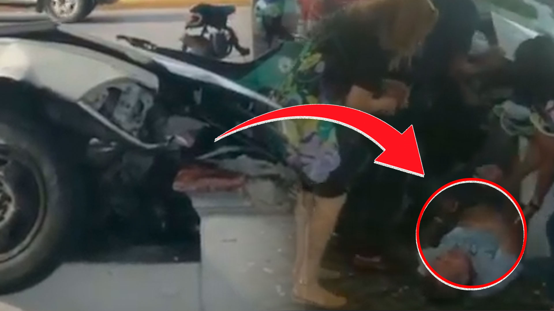 ¡Imágenes Fuertes! Hombre Pierde La Pierna Al Ser Impactado Por Un Carro En La Calle 30 De Marzo En Santiago