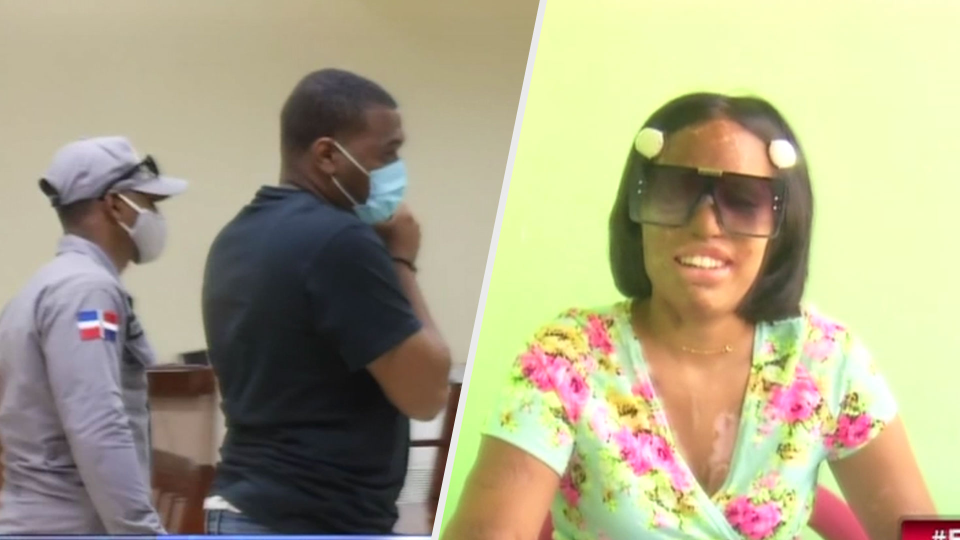 Piden 30 Años De Prisión Contra Acusados De Rociarle ácido Del Diablo A La Joven Yocairi Díaz