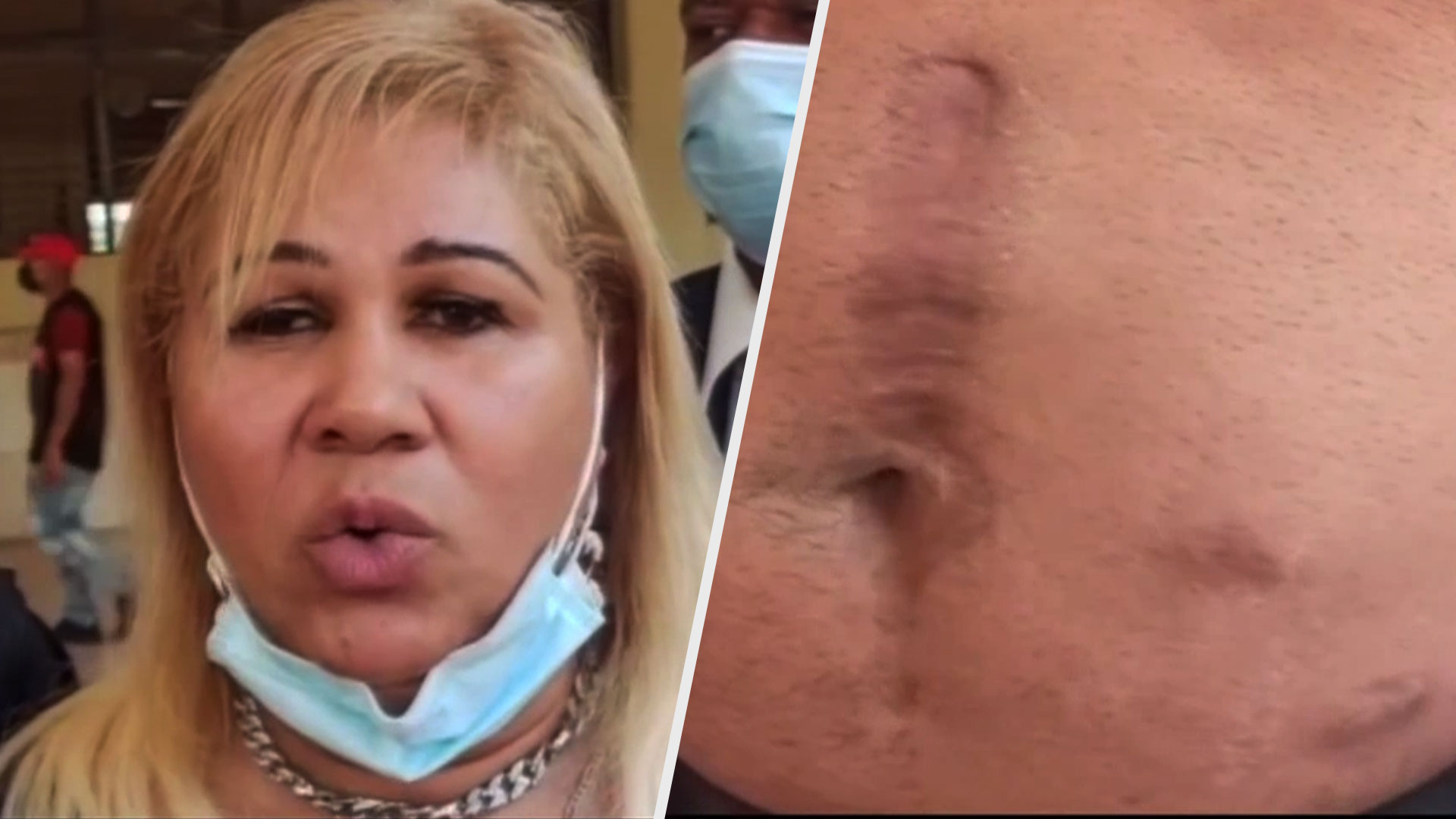 Mujer Narra Como Salvo Su Vida Junto A Su Hijo Tras Su Ex Pareja Intentar Asesinarla A Puñaladas 