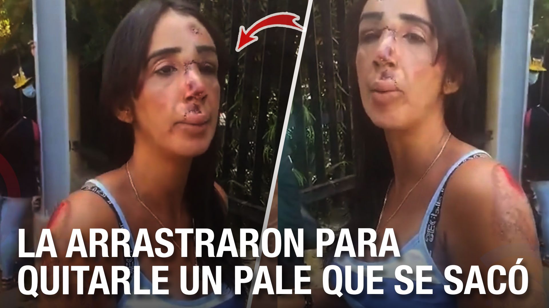 Mujer Narra Como Fue Arrastrada Por Atracadores Para Quitarle El Dinero De Un “Pale” 