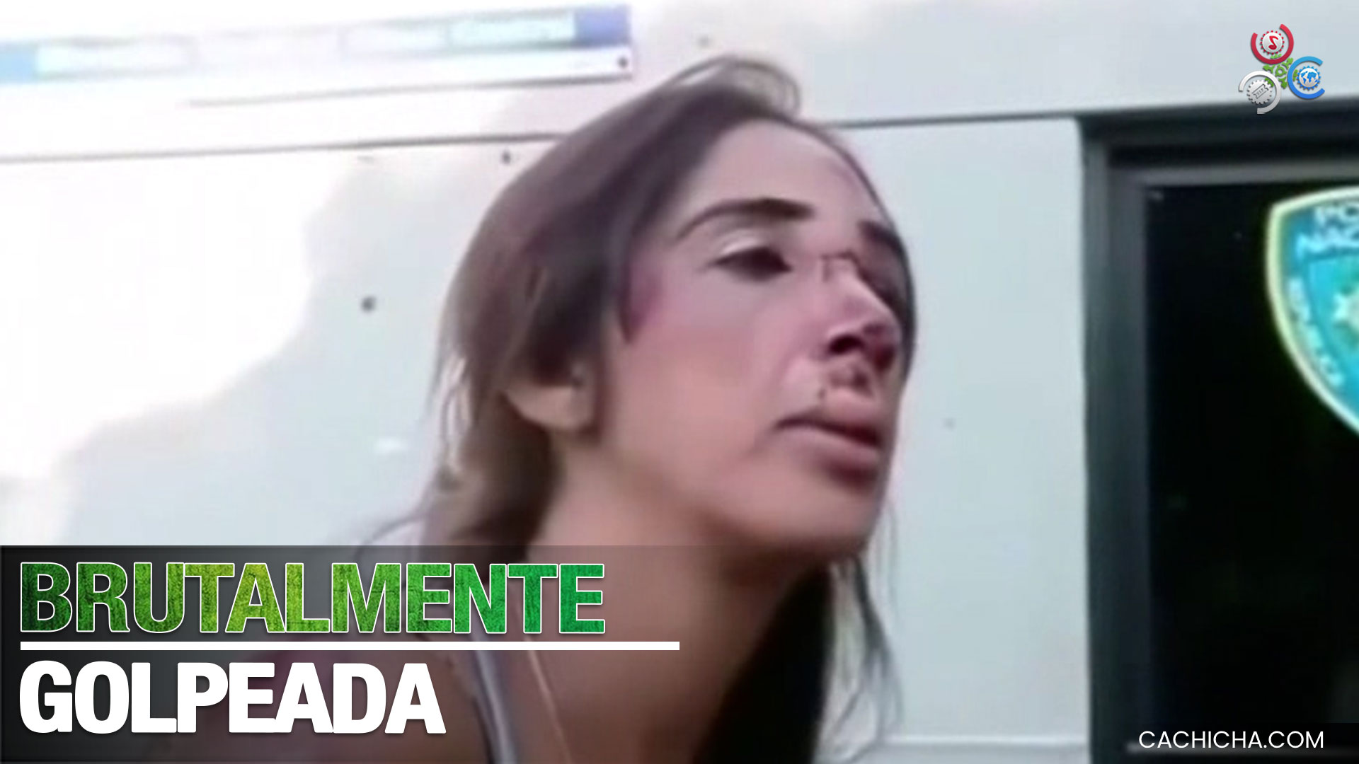 Mujer Brutalmente Golpeada Por Atracadores Para Quitarle Su Dinero