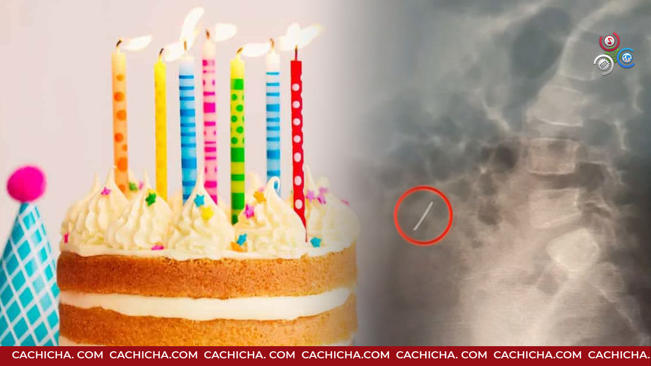 Dos Hermanitas Ingirieron Metal Incrustado En Bizcocho De Cumpleaños