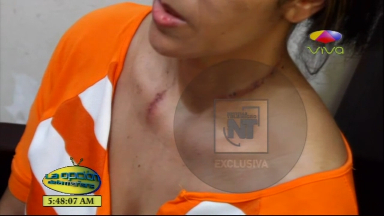 Joven Intentó Lanzarse Al Mar Caribe Había Intentado Suicidarse Anteriormente