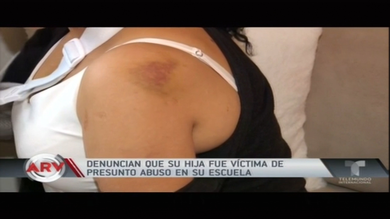 Denuncian Que Su Hija Fue Víctima De Presunto Abuso En Su Escuela