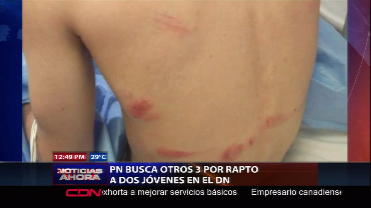 PN Busca Otros 3 Por Rapto A Dos Jóvenes En El DN
