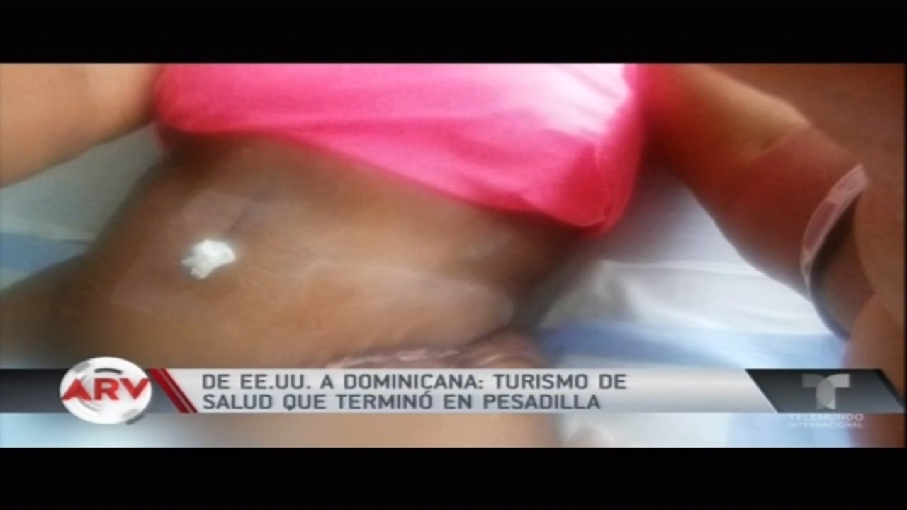De EE.UU. A Dominicana: Turismo De Salud Que Terminó En Pesadilla