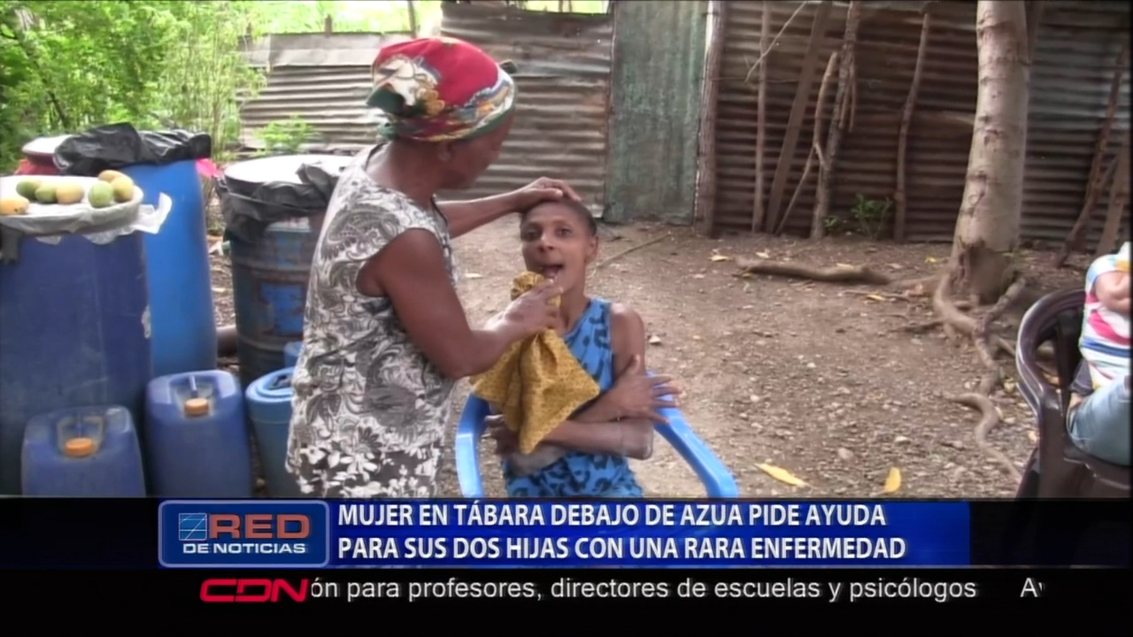 Mujer En Azua Pide Ayuda Para Sus Dos Hijas Con Una Rara Enfermedad